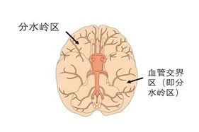 大暑时节别缺水 专家提示预防低灌性脑梗死